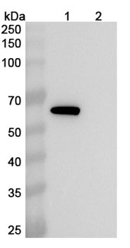 Clostridium perfringens pfo/Perfringolysin O/Theta-toxin Mouse Monoclonal Antibody