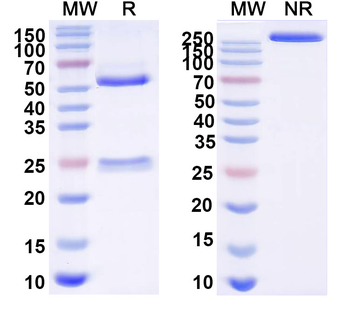 EV71 Mature virion in Complex Human Monoclonal Antibody