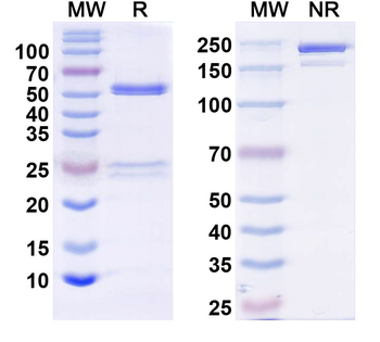 KChIP2b K+ channel Mouse Monoclonal Antibody
