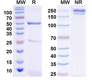 KChIP2b K+ channel Mouse Monoclonal Antibody