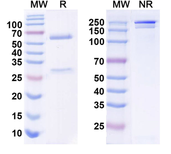 WNK3 Mouse Recombinant Antibody