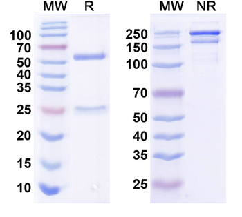WNK3 Mouse Recombinant Antibody