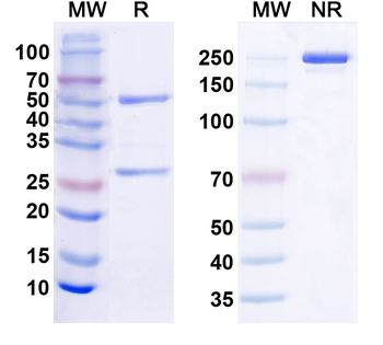 NSD1 Mouse Monoclonal Antibody