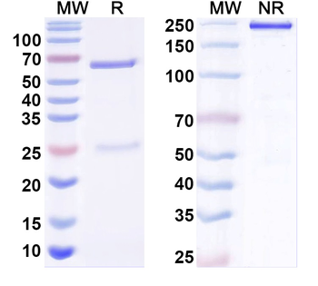 BBS1 Mouse Monoclonal Antibody