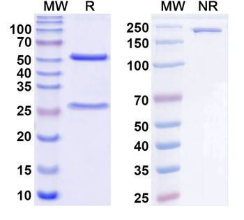 SCARB2/LIMP-2 Mouse Monoclonal Antibody