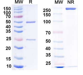 LRRTM2 Mouse Monoclonal Antibody