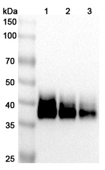 IL12B/IL-12 p40/NKSF2 Human Monoclonal Antibody