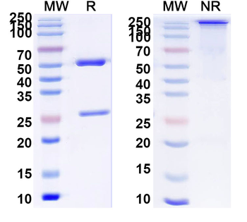 IL6 Human Monoclonal Antibody