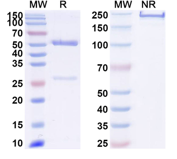 TBEV Envelope protein E Mouse Monoclonal Antibody