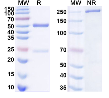 SARS-CoV-2 RBD Human Monoclonal Antibody