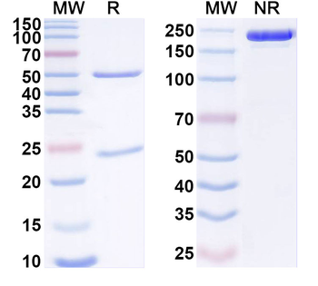 ADGRL4/ELTD1 Mouse Monoclonal Antibody
