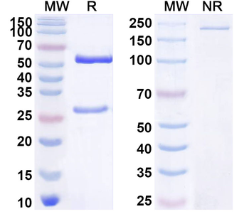 SERPINF1/PEDF/Serpin F1 Mouse Monoclonal Antibody