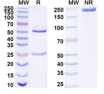 DAB2IP Mouse Recombinant Antibody