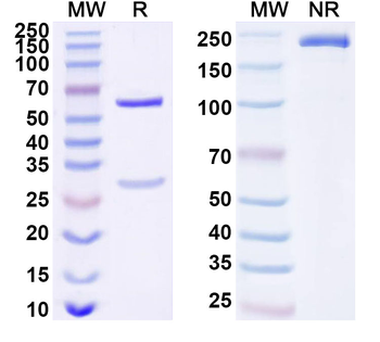 MCM6 Mouse Monoclonal Antibody