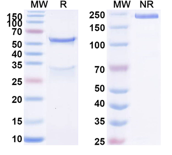 EPHB2 Mouse Monoclonal Antibody