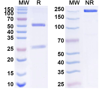 GLUT4/SLC2A4 Mouse Monoclonal Antibody