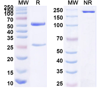HBV-A S/L-HBsAg/L glycoprotein Human Monoclonal Antibody