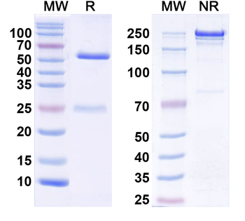 β-tryptase/TPSAB1 Mouse Monoclonal Antibody