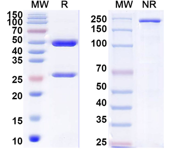 Influenza A virus HA/Hemagglutinin Human Monoclonal Antibody