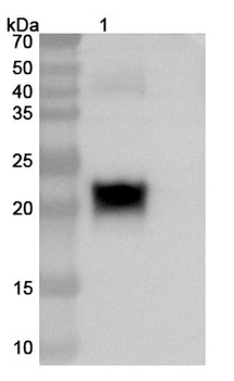 PTP4A3/PRL3 Human Monoclonal Antibody
