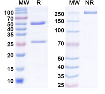 MARV NP/Nucleoprotein Human Monoclonal Antibody
