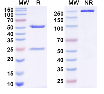 Influenza A virus HA/Hemagglutinin Human Monoclonal Antibody