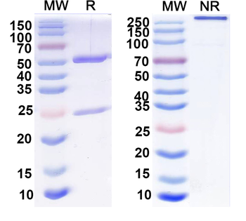 HBV S/L-HBsAg/L glycoprotein Human Monoclonal Antibody
