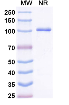 VSIG4/CRIg Mouse Monoclonal Antibody