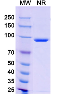 Sudan ebolavirus/SEBOV NP/Nucleoprotein Mouse Monoclonal Antibody