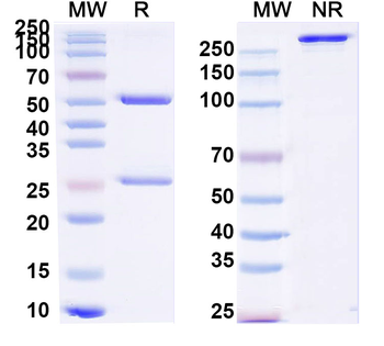 KRT8/18 Mouse Monoclonal Antibody