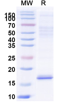 HCMV/HHV5 HHRF3/US28 Camelus Monoclonal Antibody