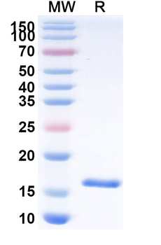 HCMV/HHV5 HHRF3/US28 Camelus Monoclonal Antibody
