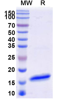 SARS-CoV S/Spike glycoprotein Camelus Monoclonal Antibody