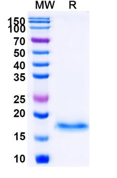 Vesicular stomatitis Indiana virus/VSIV NP/Nucleoprotein Camelus Monoclonal Antibody