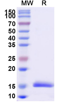 Vesicular stomatitis Indiana virus/VSIV NP/Nucleoprotein Camelus Monoclonal Antibody