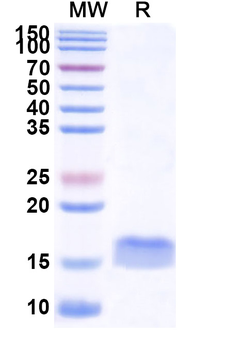 Human papillomavirus type 16 E7/Protein E7 Camelus Monoclonal Antibody
