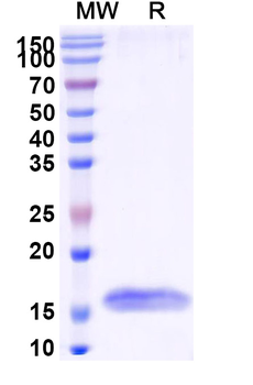 HIV1 Surface protein gp120 Camelus Monoclonal Antibody