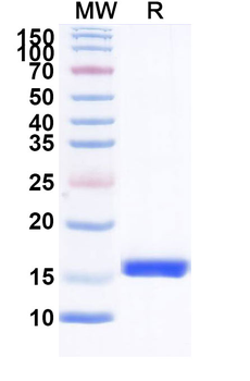 HIV1 Surface protein gp120 Camelus Monoclonal Antibody