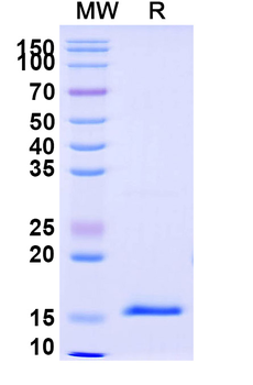DKK1 Camelus Monoclonal Antibody