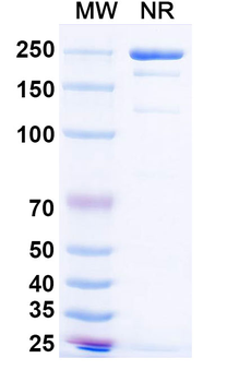 HMPV F/Fusion Protein Human Monoclonal Antibody