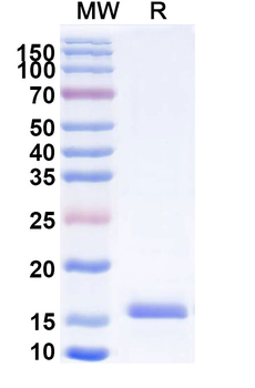 CD66e/CEA/CEACAM5 Camelus Monoclonal Antibody