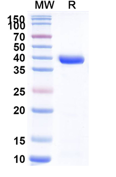MPXV A29L Human Monoclonal Antibody