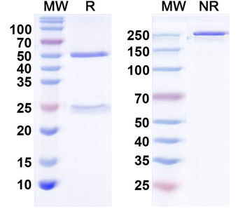 CX3CL1/Fractalkine Human Monoclonal Antibody