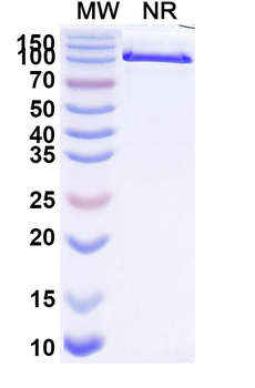 CCL3/MIP-1-alpha Human Monoclonal Antibody