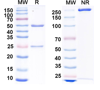 Influenza A virus NP/Nucleoprotein Human Monoclonal Antibody