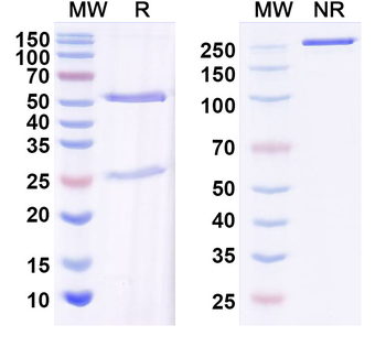 HIV1 gp120/Glycoprotein 120 Human Monoclonal Antibody