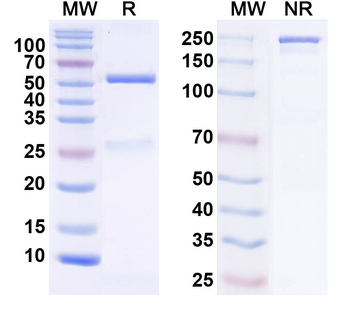 IL18/IL1F4 Human Monoclonal Antibody
