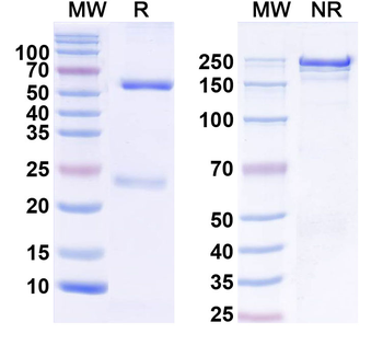 IL17A Human Monoclonal Antibody