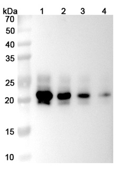 IL6 Human Monoclonal Antibody