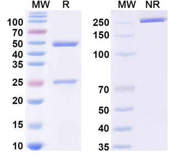 HPV B19/B19V VP1/Coat protein VP1 Human Monoclonal Antibody
